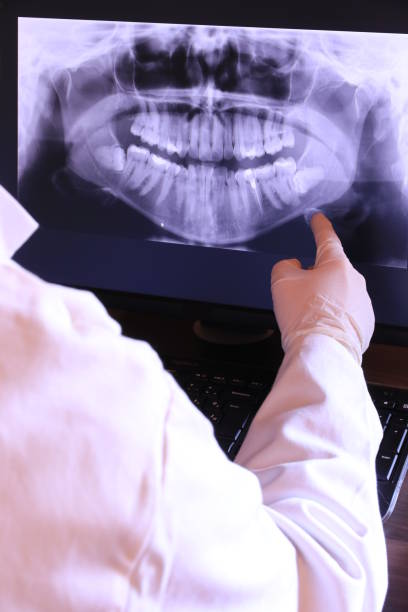 Best Emergency Wisdom Teeth Removal in San Saba, TX