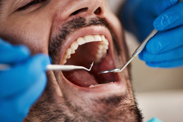 Best Same-Day Emergency Dental Services in San Saba, TX
